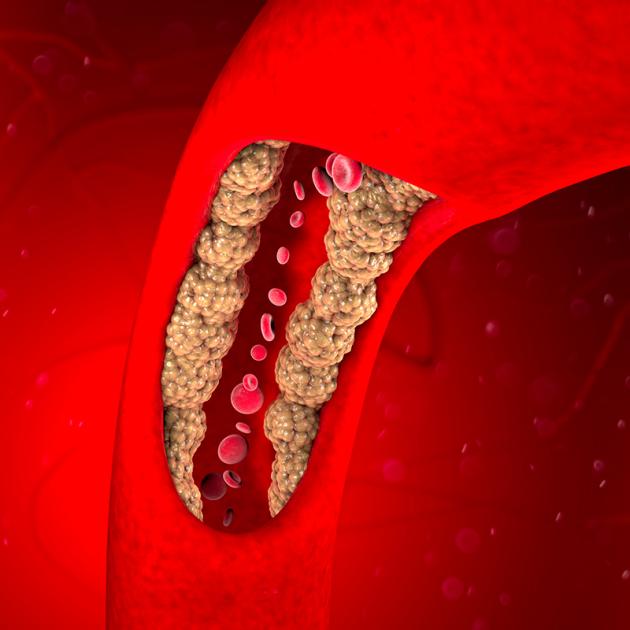 Lipids and Metabolic Health